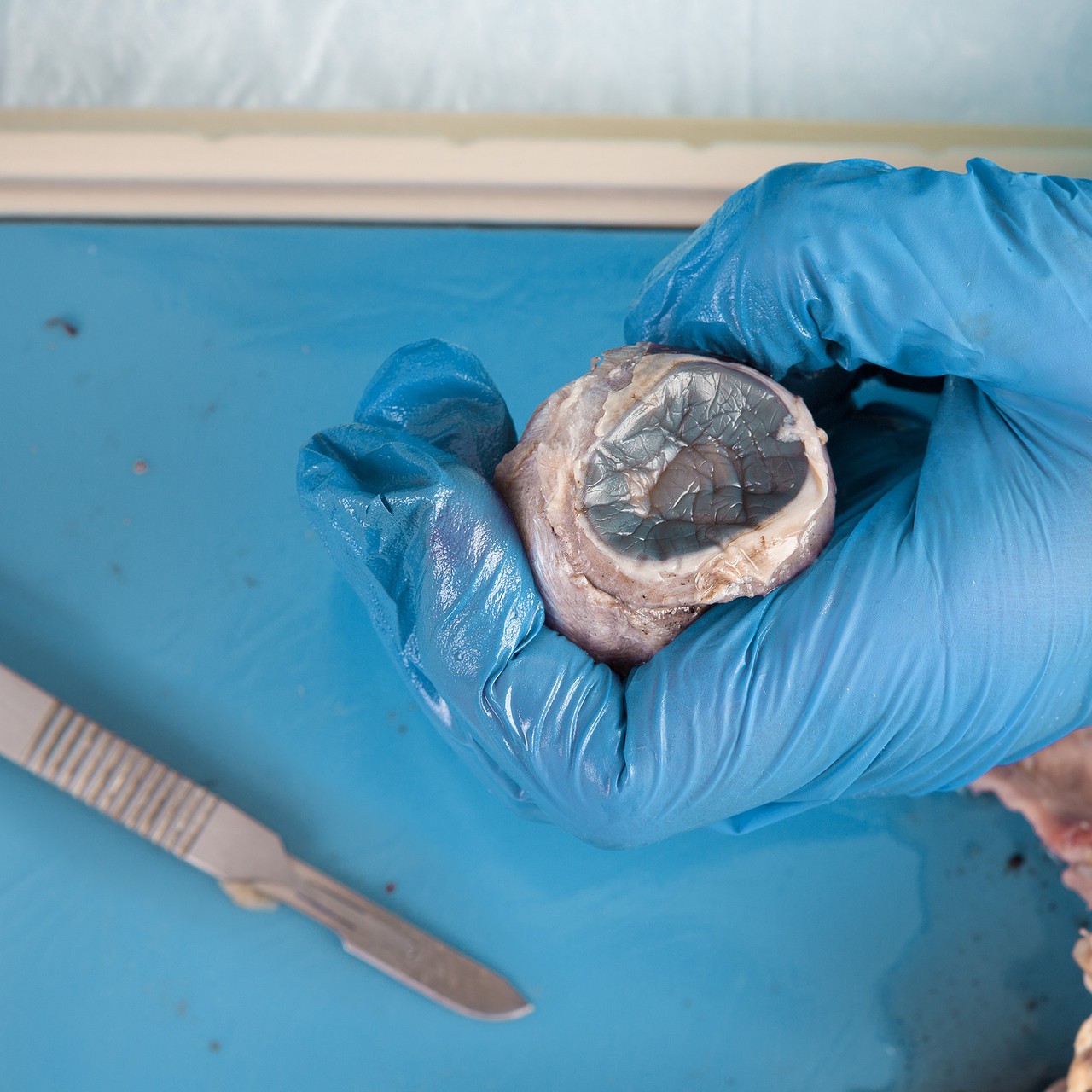 Sheep eye specimen being dissected on a wax dissection pan