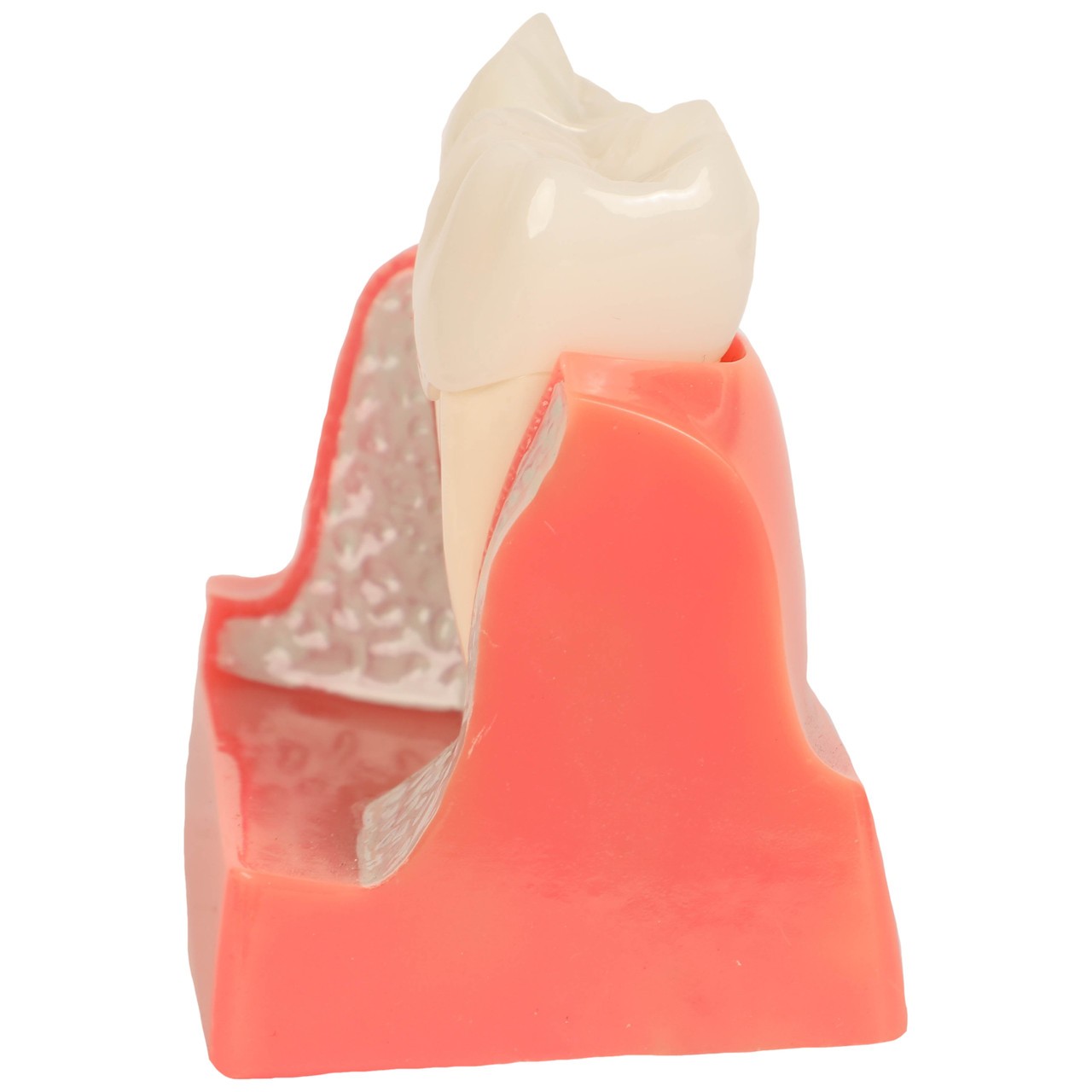 Axis Scientific Enlarged Dental Implant Anatomy Model