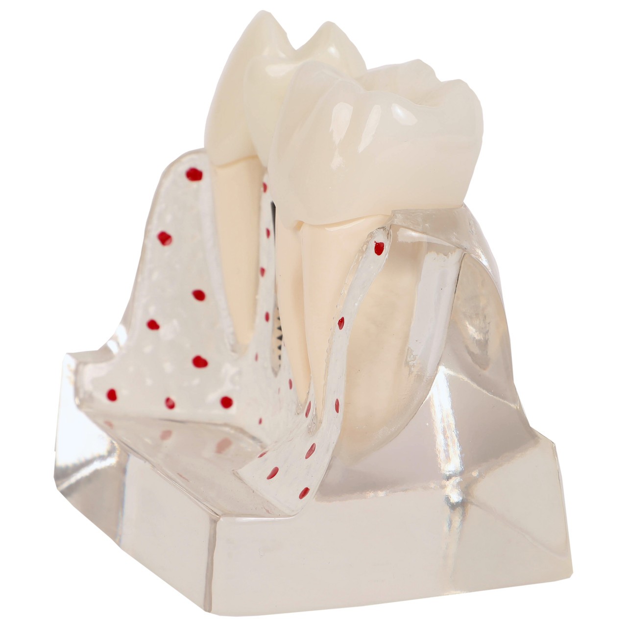 Axis Scientific Enlarged Transparent Dental Implant Anatomy Model