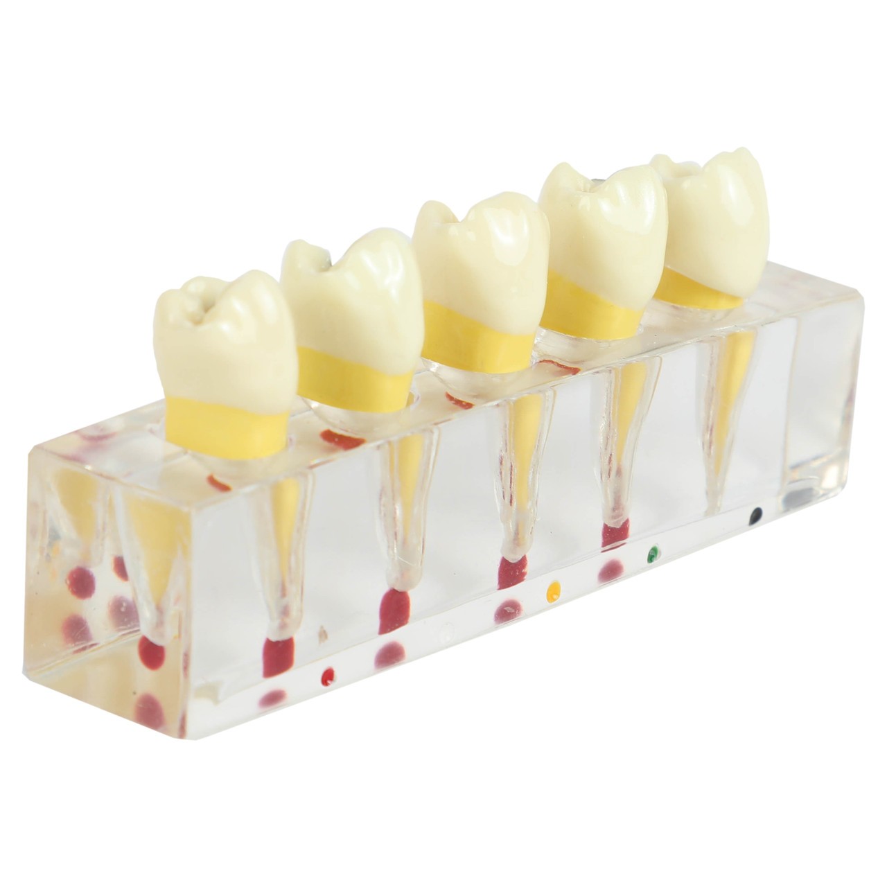 Axis Scientific Dental Pulp Repair Anatomy Model Top Down View of Individual Teeth Screws
