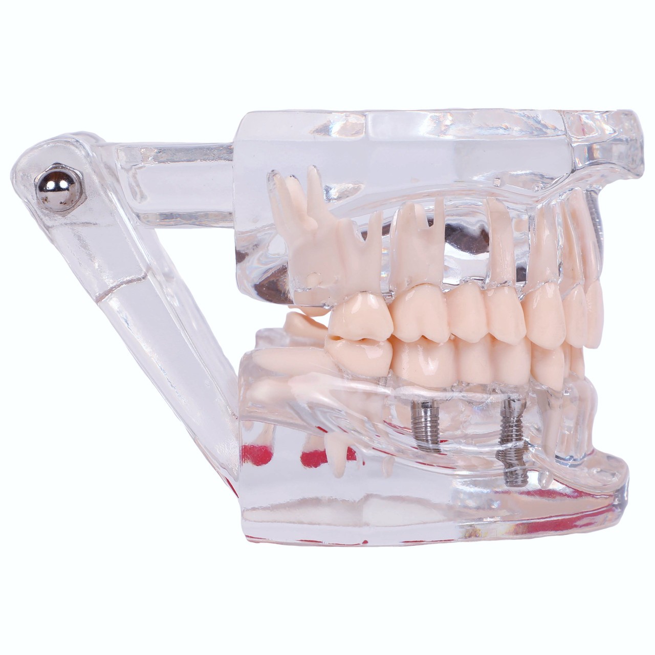 Axis Scientific Transparent Permanent Teeth Anatomy Model