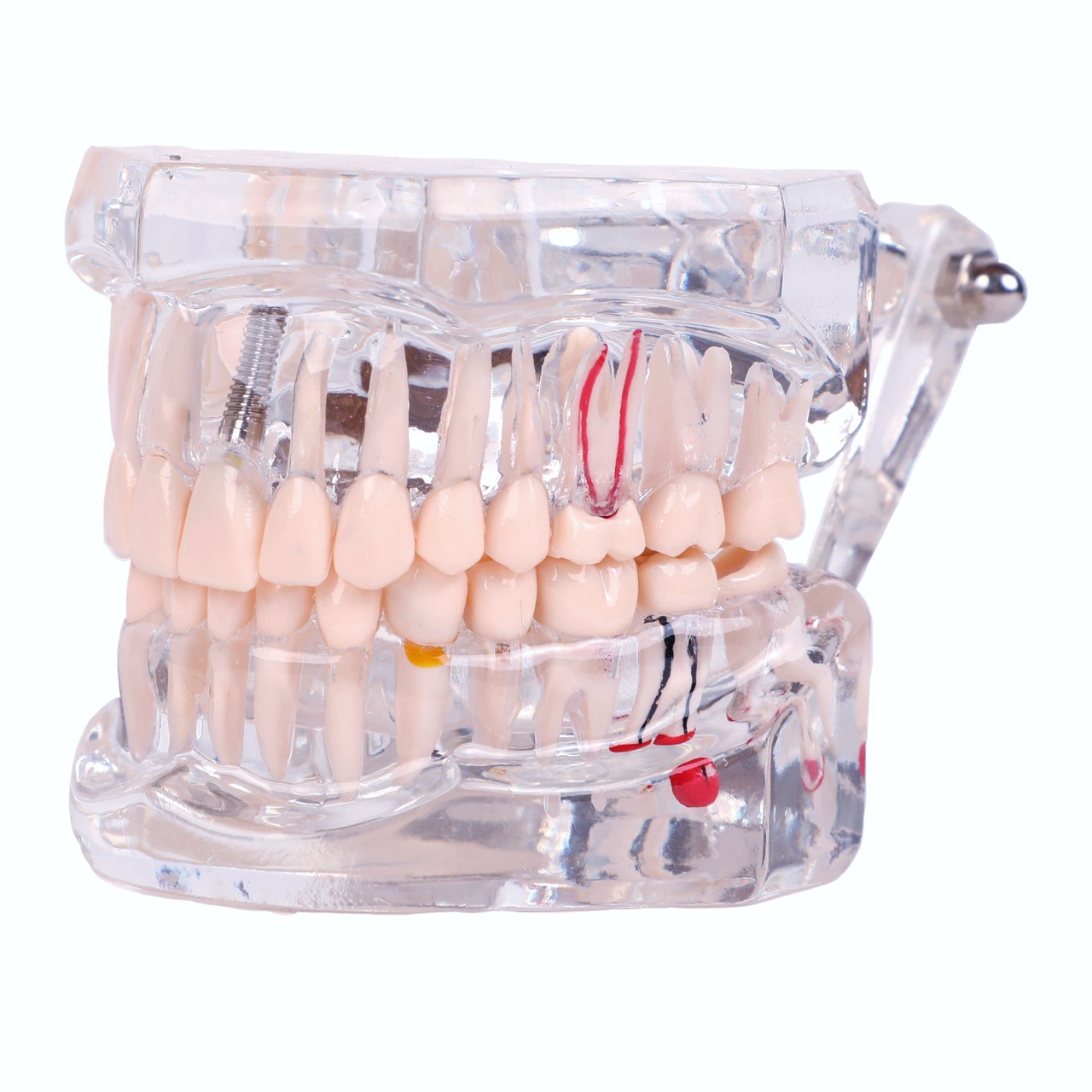 Axis Scientific Transparent Permanent Teeth Anatomy Model