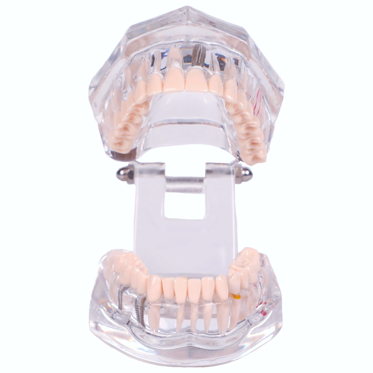 Axis Scientific Transparent Permanent Teeth Anatomy Model