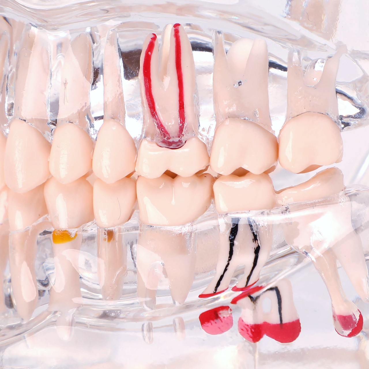 Axis Scientific Transparent Permanent Teeth Anatomy Model