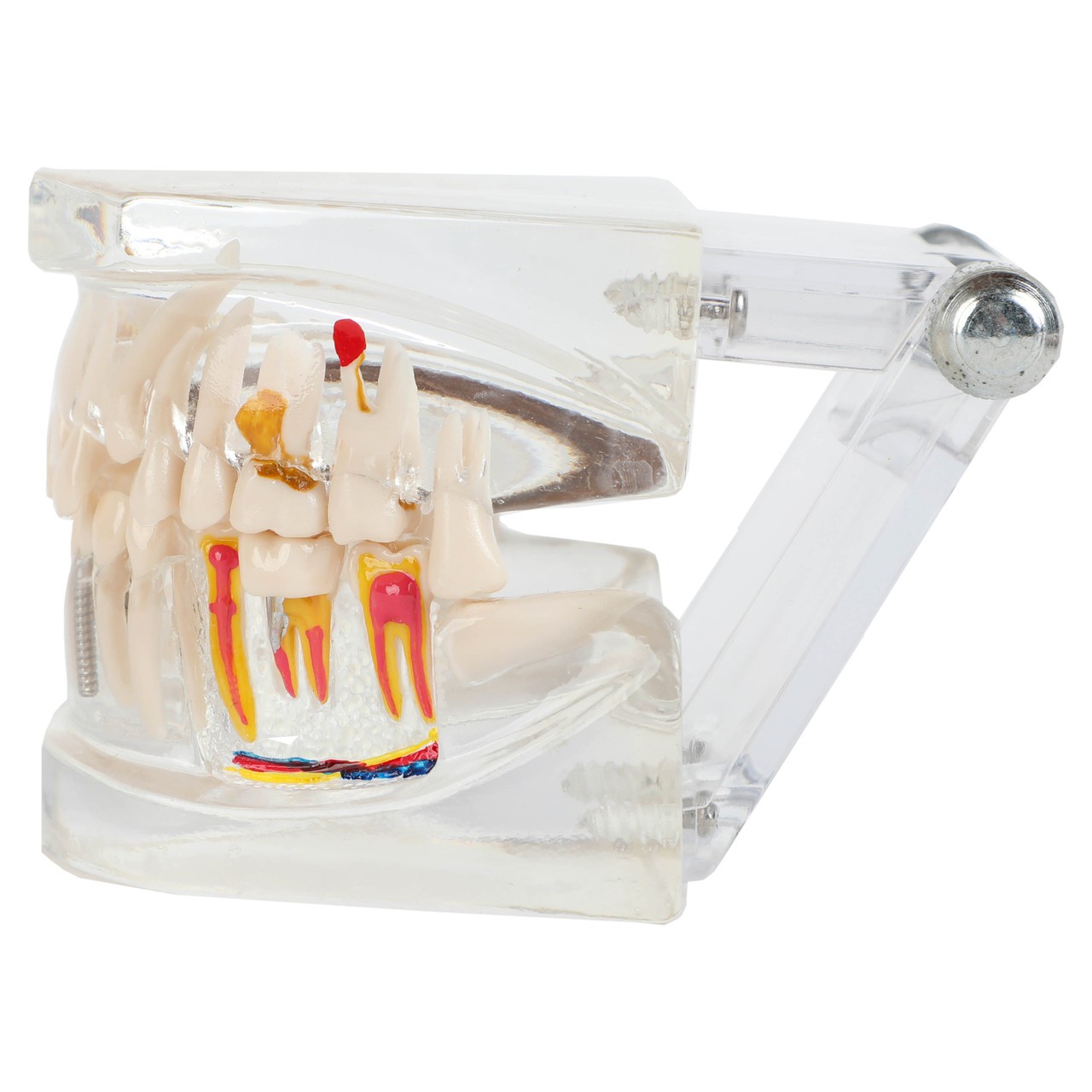 Axis Scientific Transparent Diseased Teeth Anatomy Model