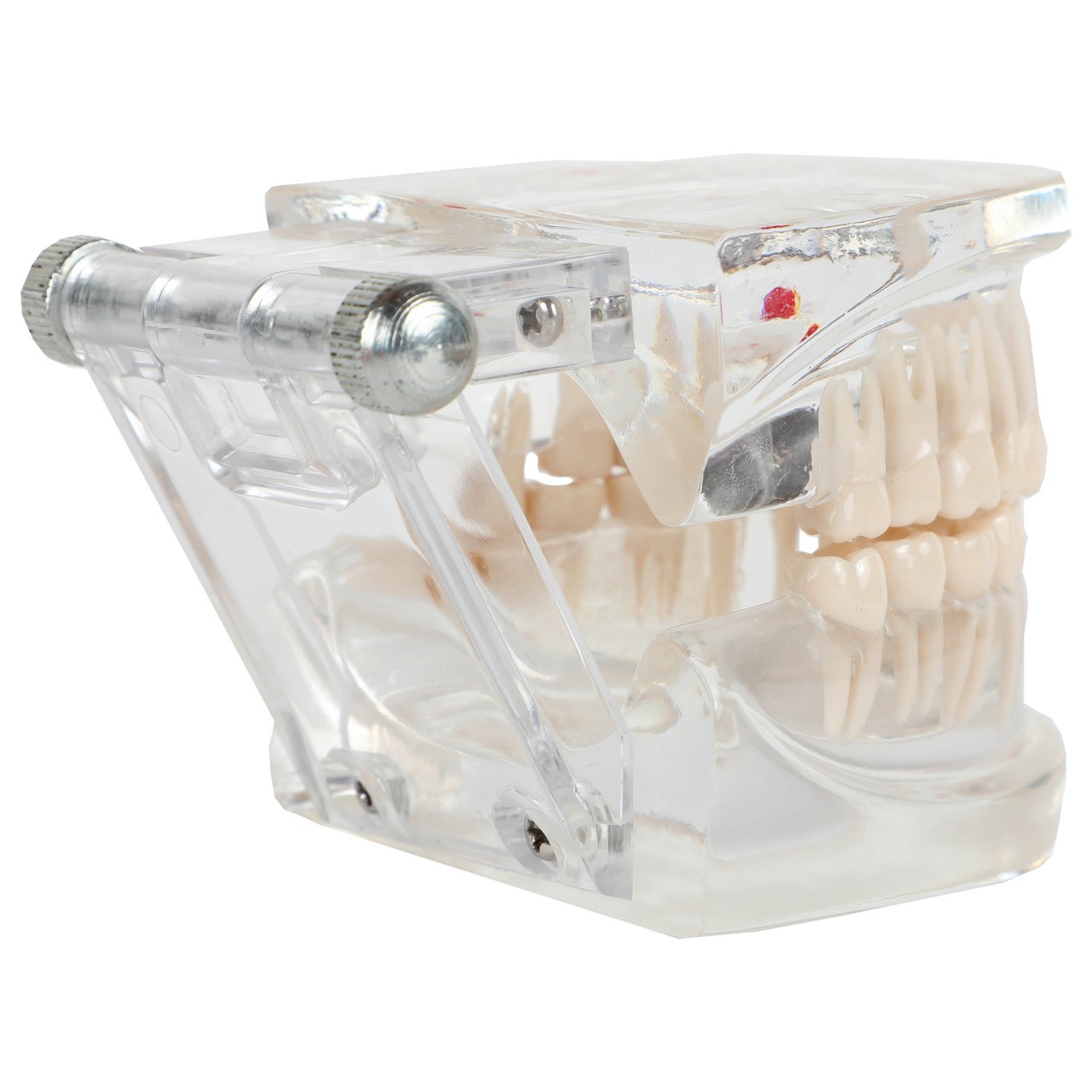 Axis Scientific Transparent Diseased Teeth Anatomy Model