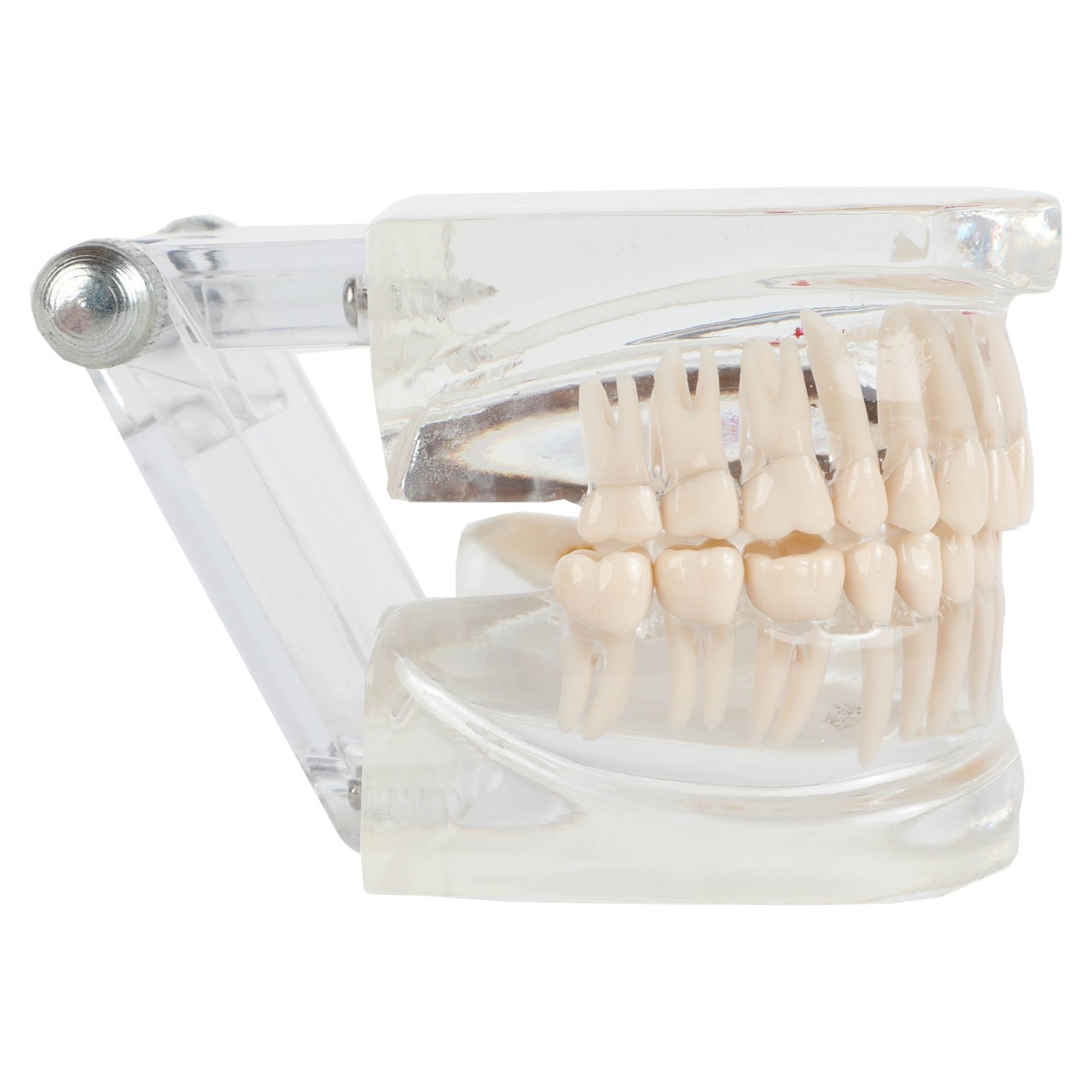 Axis Scientific Transparent Diseased Teeth Anatomy Model