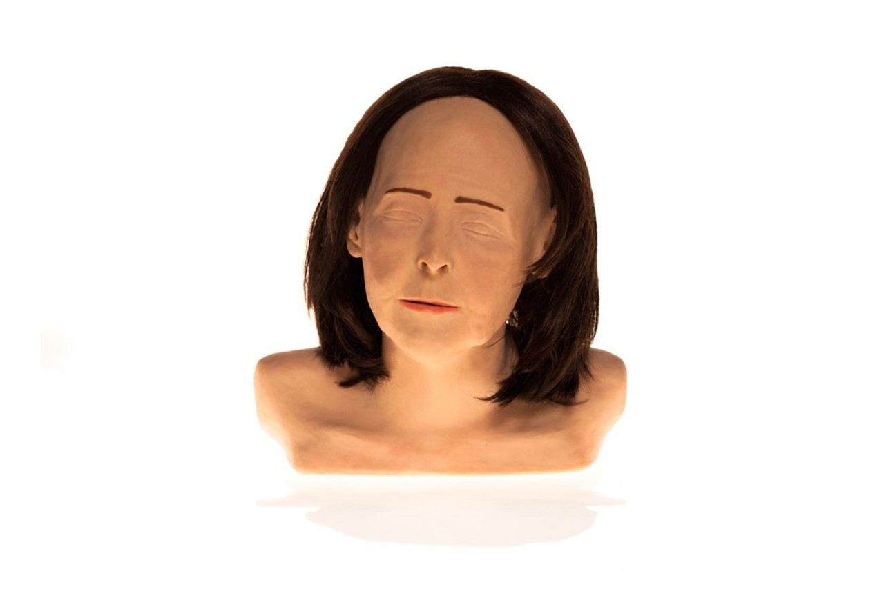 SimSkin Cosmetic Filler Training Model - Zsa Zsa - Front View of the Head and Shoulders
