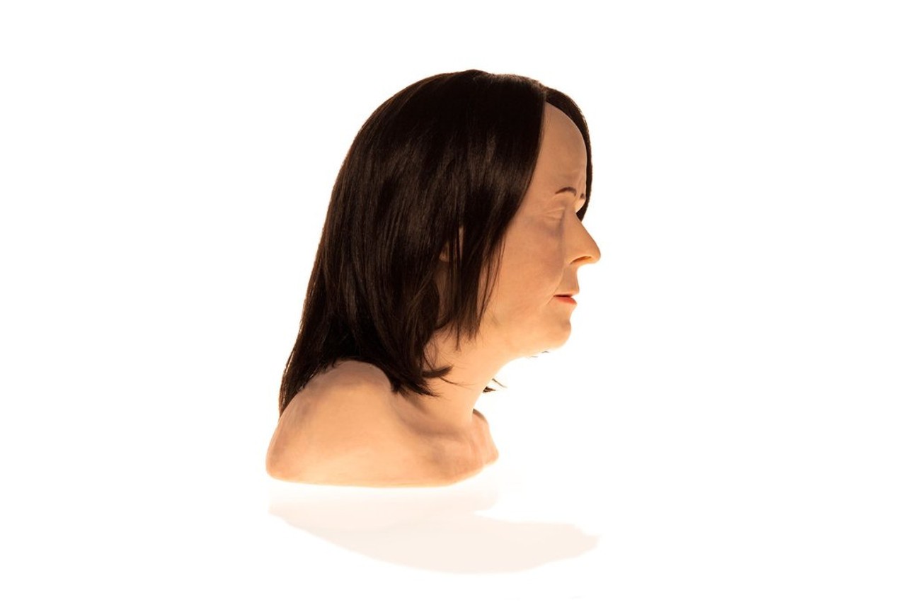 SimSkin Cosmetic Filler Training Model - Zsa Zsa - Right Side View of the Head and Shoulder