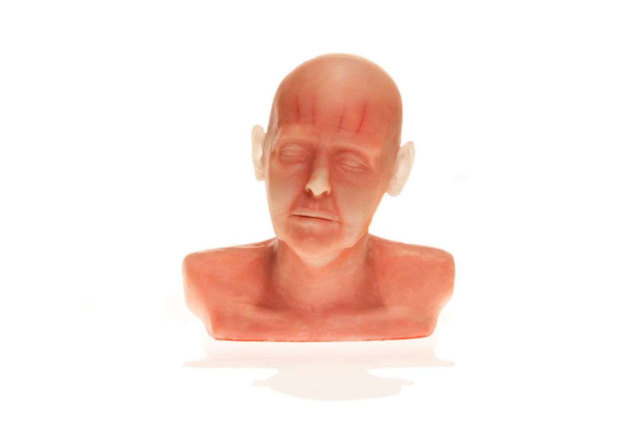 SimSkin Cosmetic Filler Training Model - Diaphanous Zsa Zsa - Front View of the Head and Shoulder