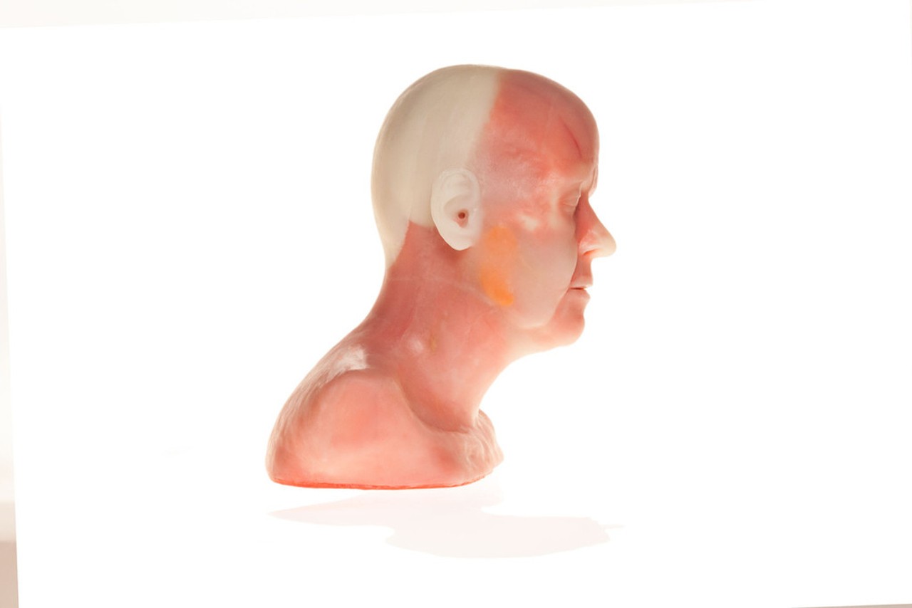 SimSkin Cosmetic Filler Training Model - Diaphanous Zsa Zsa - Right Side View of the Head and Shoulder