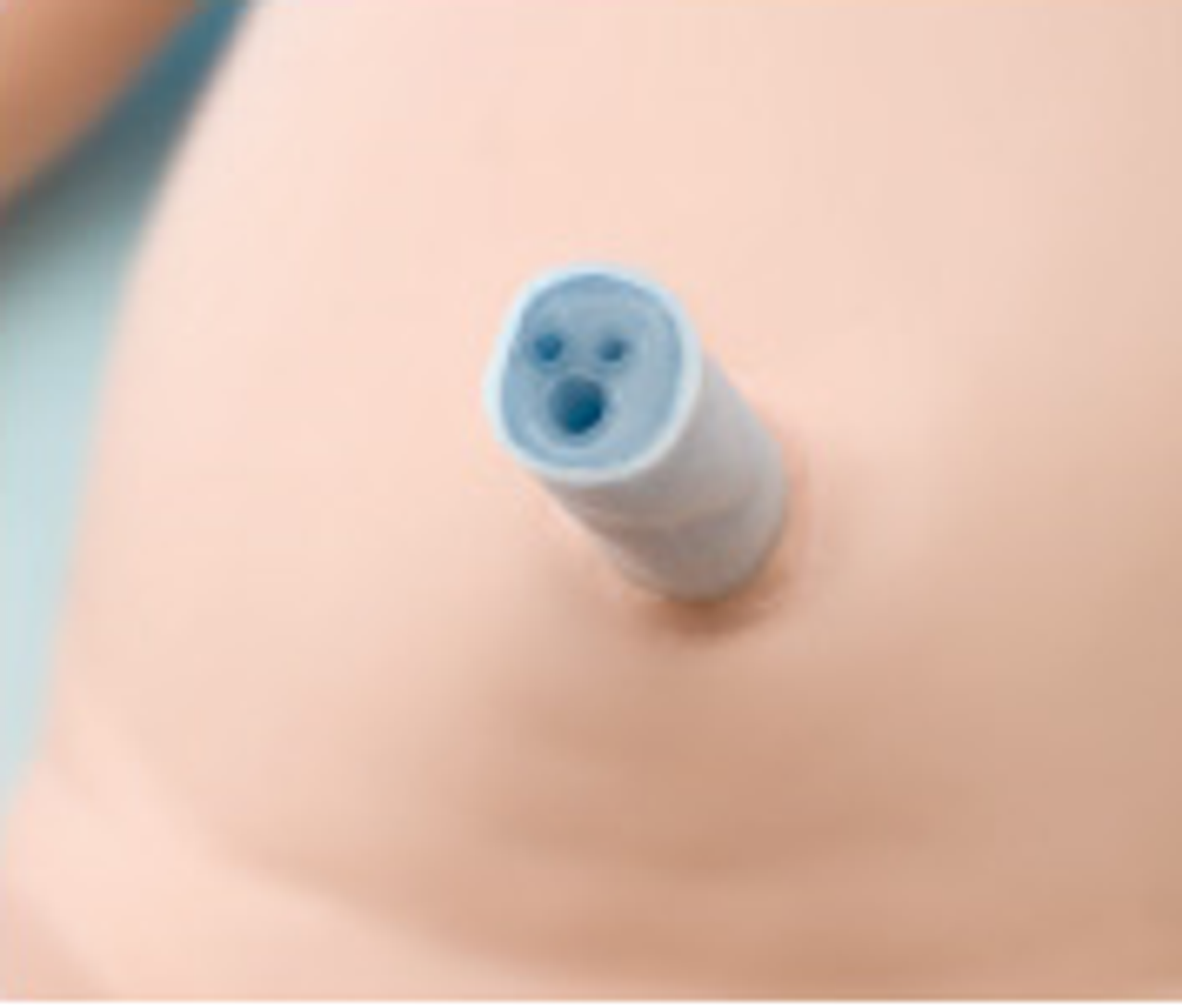 Umbilical cord