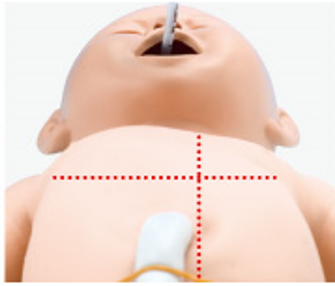 One-sided lung intubation