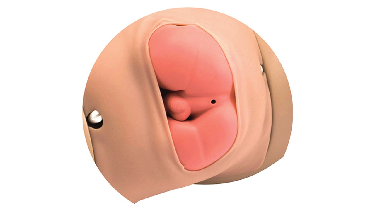 Breech Extraction