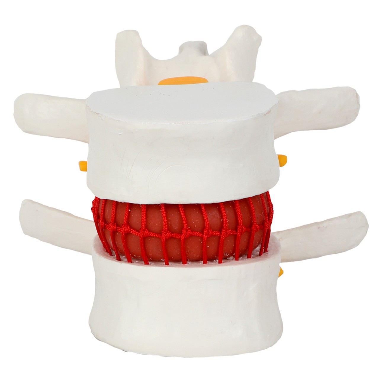 Axis Scientific Human Lumbar Herniating Disc Anatomy Model - Front View