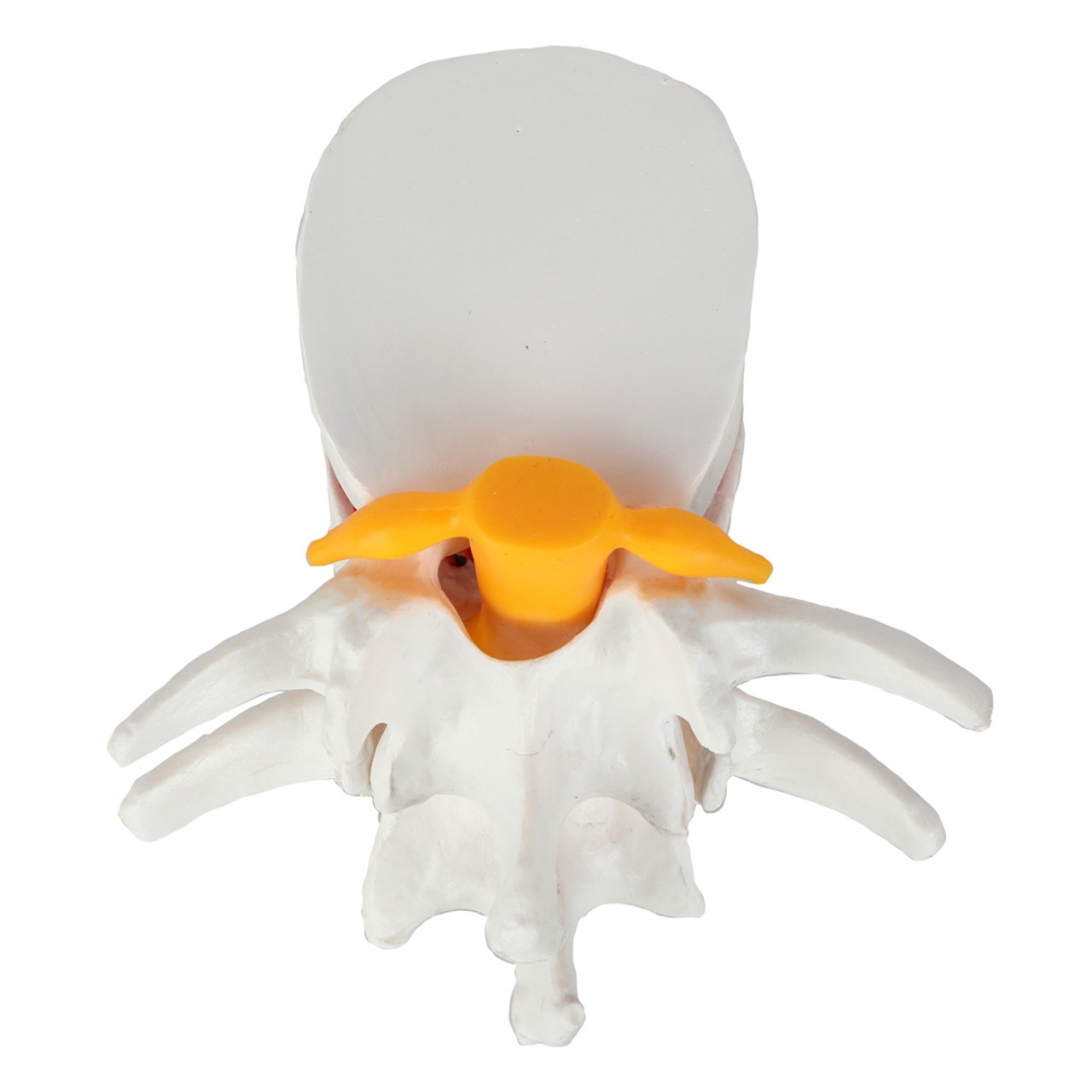 Axis Scientific Human Lumbar Herniating Disc Demonstration Anatomy Model - Bottom View