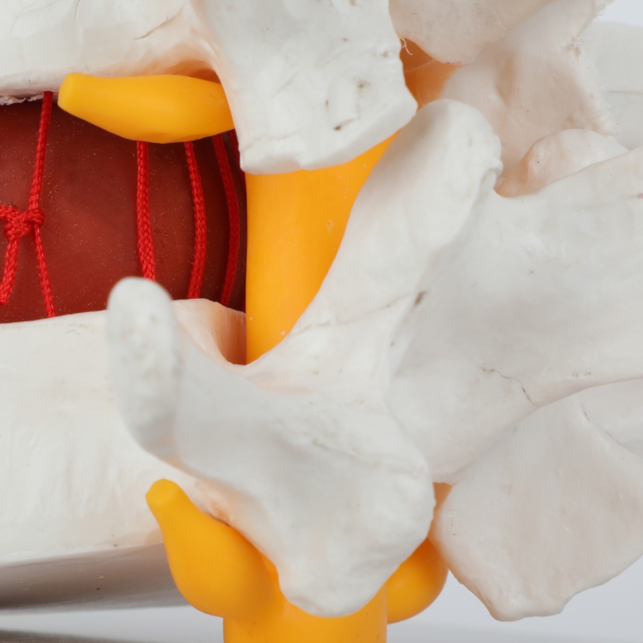 Axis Scientific Human Lumbar Herniating Disc Demonstration Anatomy Model - Detail of Netting that Encases the Spinal Disk