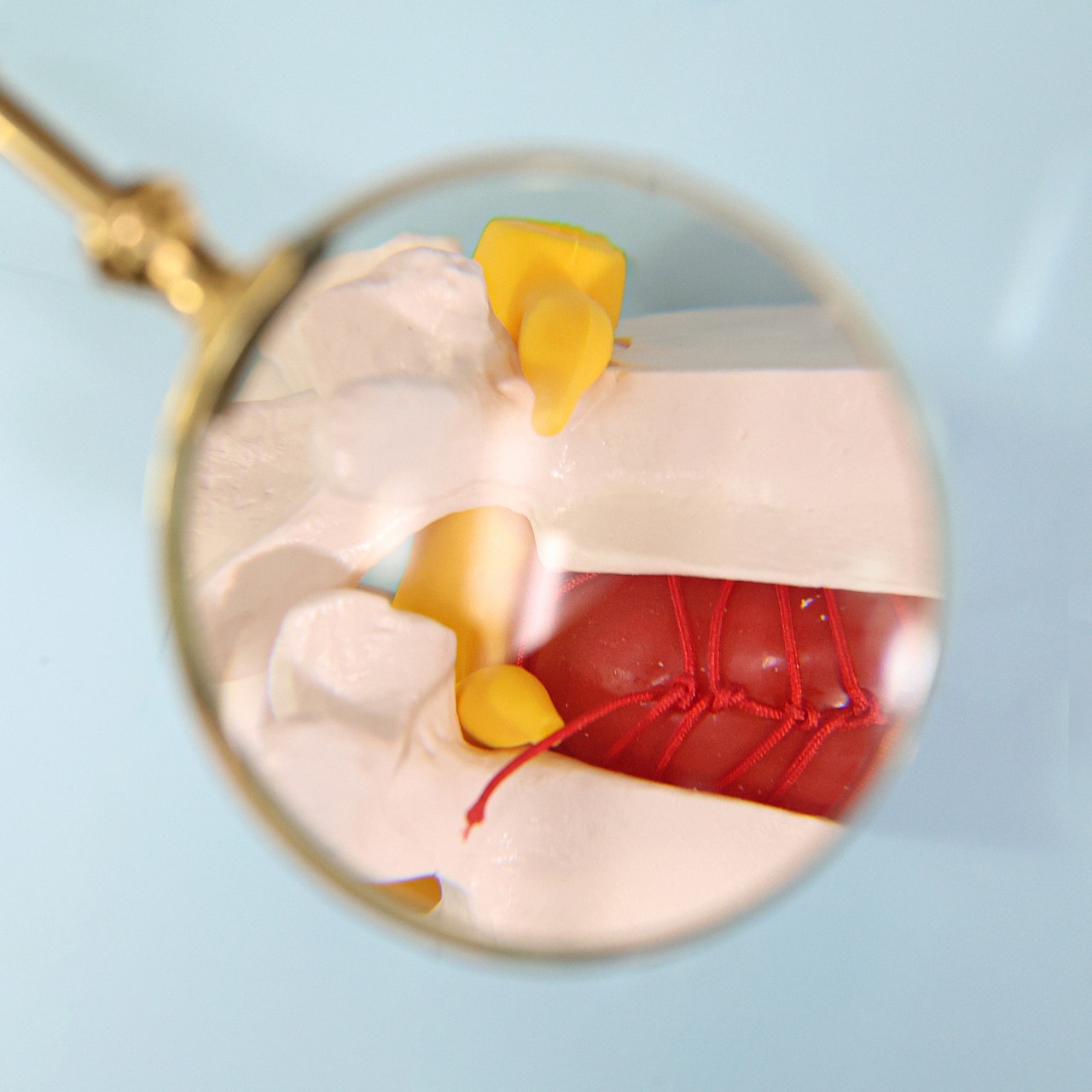 Axis Scientific Human Lumbar Herniating Disc Demonstration Anatomy Model
