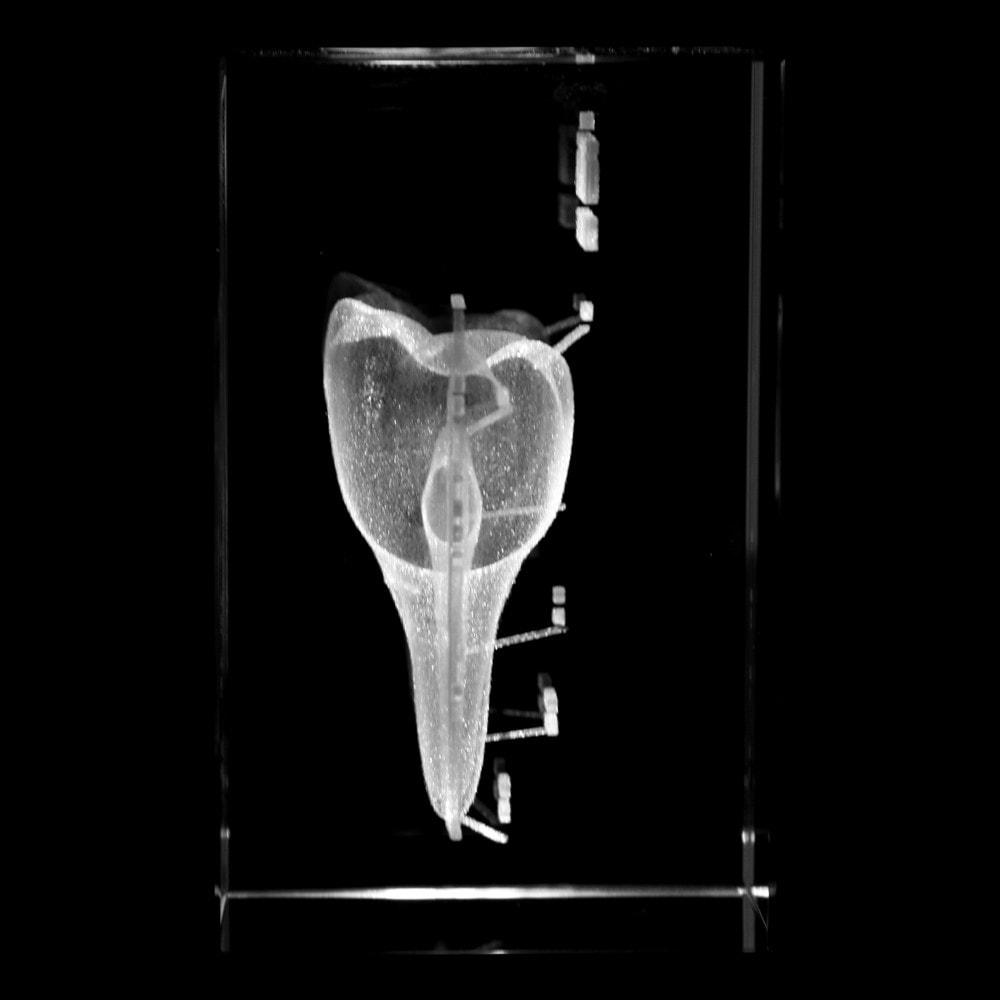 Axis Scientific 3D Etched Glass Human Tooth Model | Anatomy Warehouse
