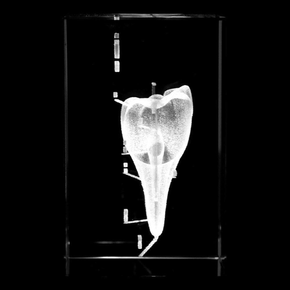 Axis Scientific 3D Etched Glass Human Tooth Model | Anatomy Warehouse