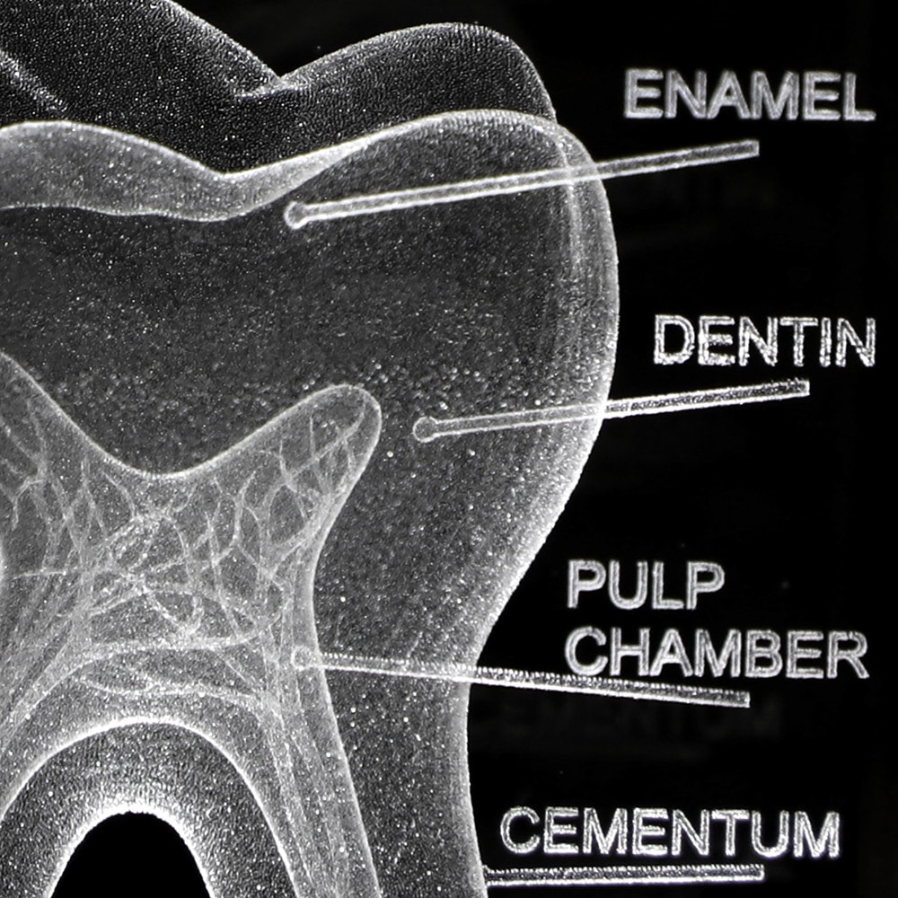 Axis Scientific 3D Etched Glass Human Tooth Model | Anatomy Warehouse