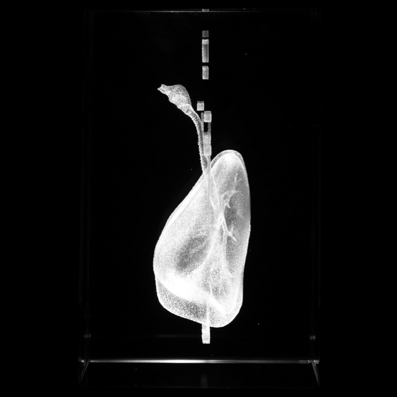 Axis Scientific 3D Etched Glass Human Pulmonary Model - Right Side View