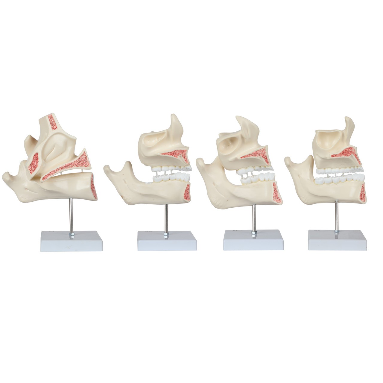 Axis Scientific Human Dental Development Anatomy Model