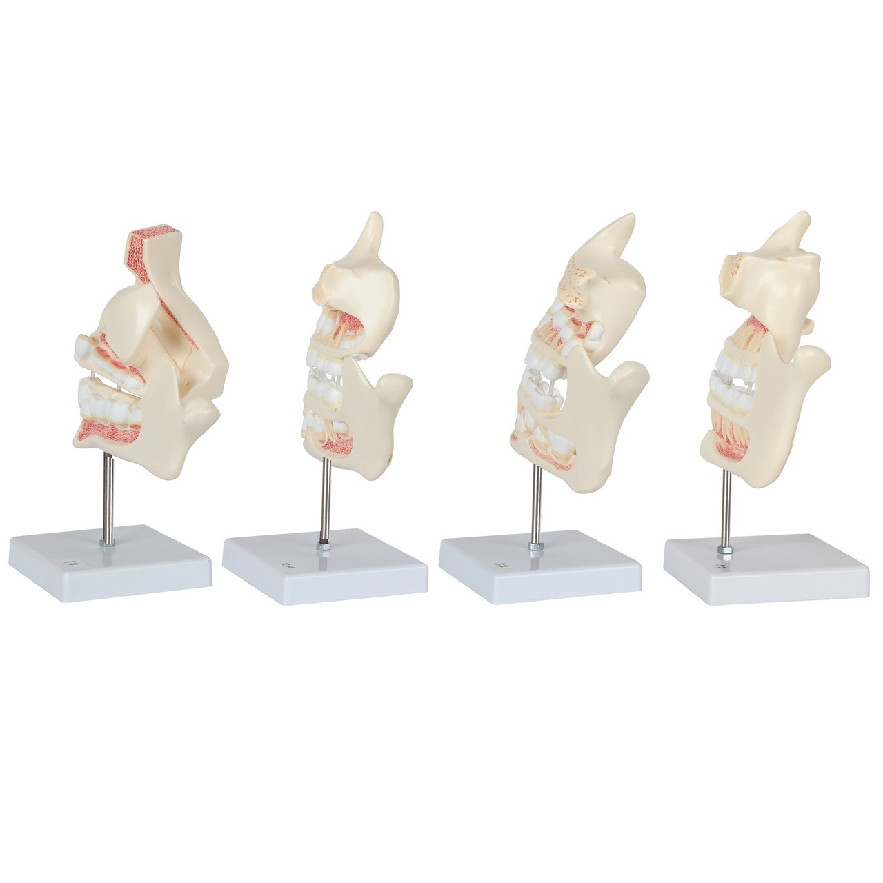 Axis Scientific Human Dental Development Anatomy Model