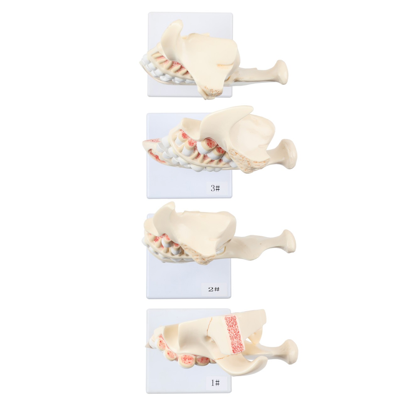Axis Scientific Human Dental Development Anatomy Model