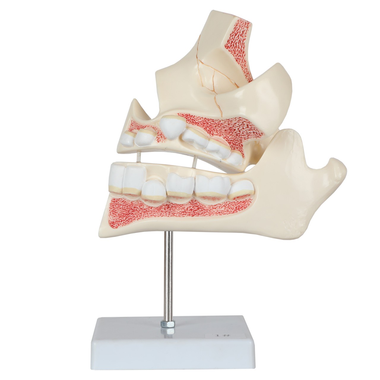Axis Scientific Human Dental Development Anatomy Model
