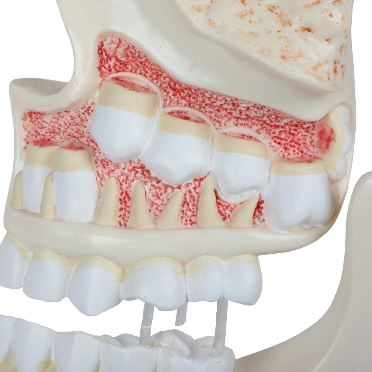 Axis Scientific Human Dental Development Anatomy Model