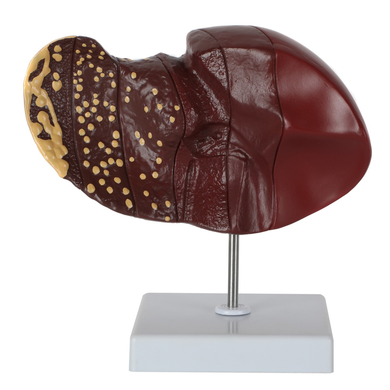 Axis Scientific Life-Size Human Liver with the Progression of Liver Disease