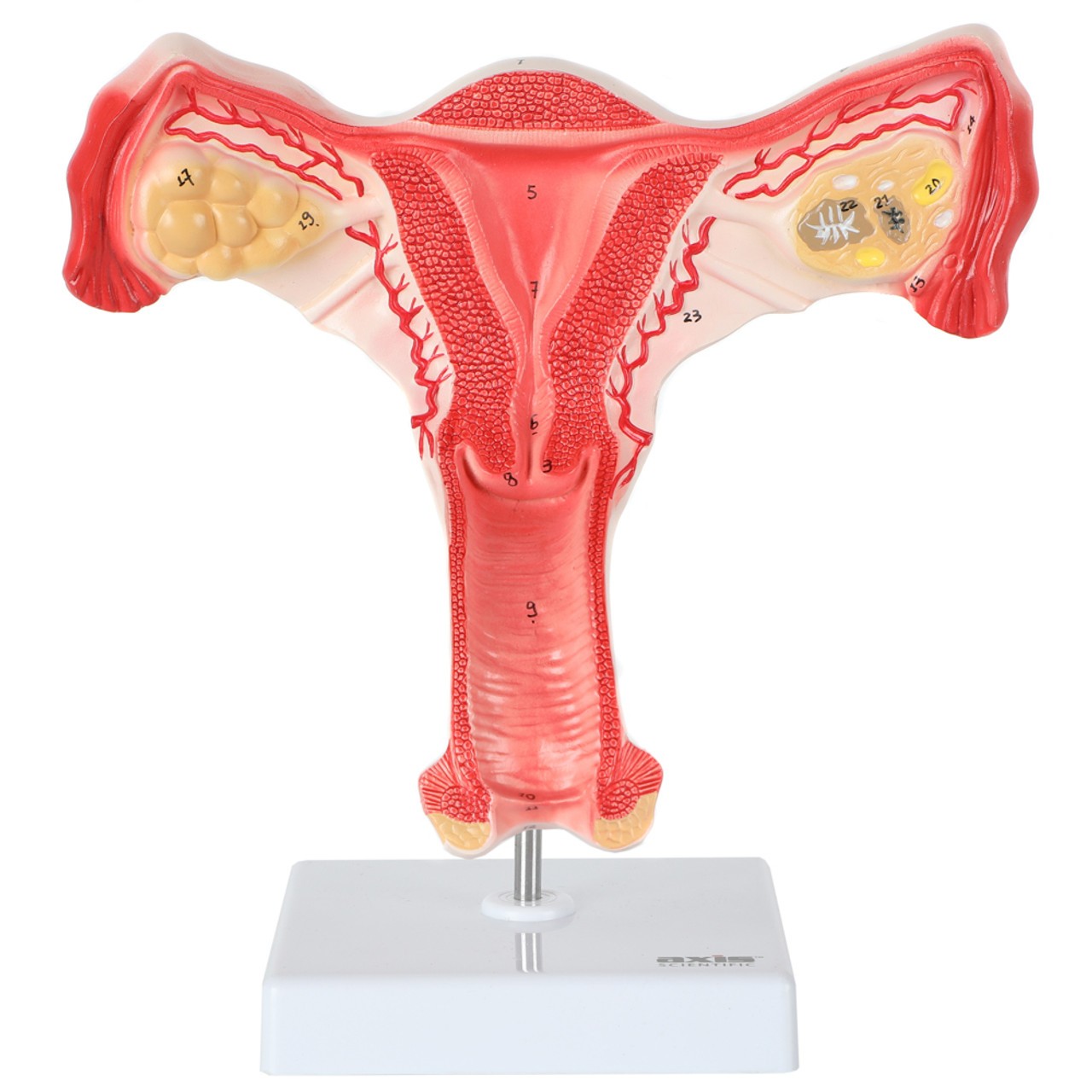 Axis Scientific Female Genital Organs Model | Anatomy Warehouse