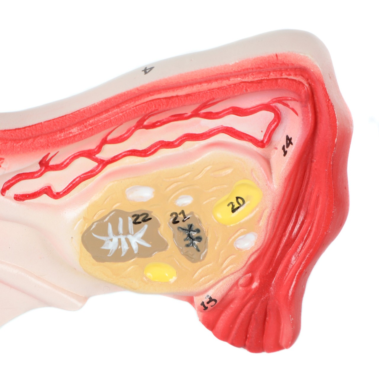 Axis Scientific Female Genital Organs Model - close up of a healthy ovary - right side