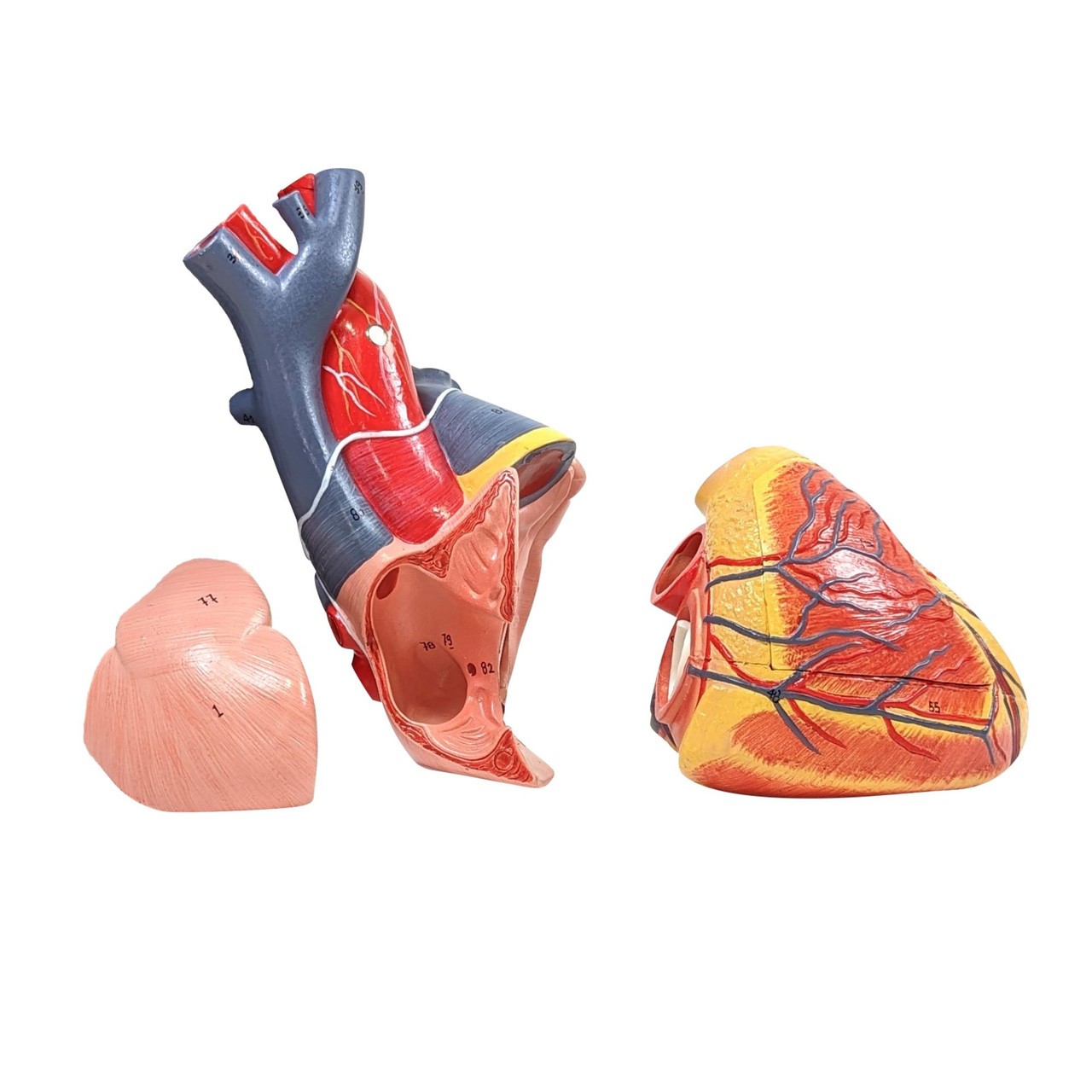 Axis Scientific 15-Part Laryngeal Cardiopulmonary Anatomy Model - Side View Showing Cut Ribs and Right Lung