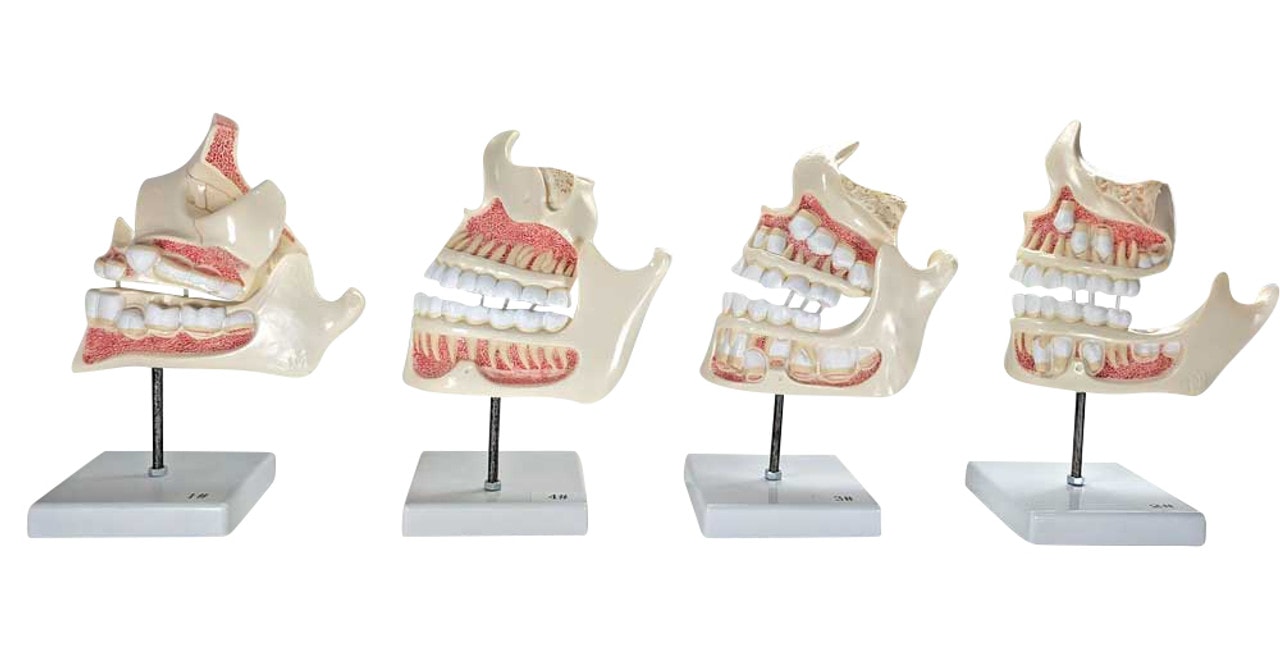 Front View - Axis Scientific 4-Stage Development of the Human Teeth - Used, Sold As-Is