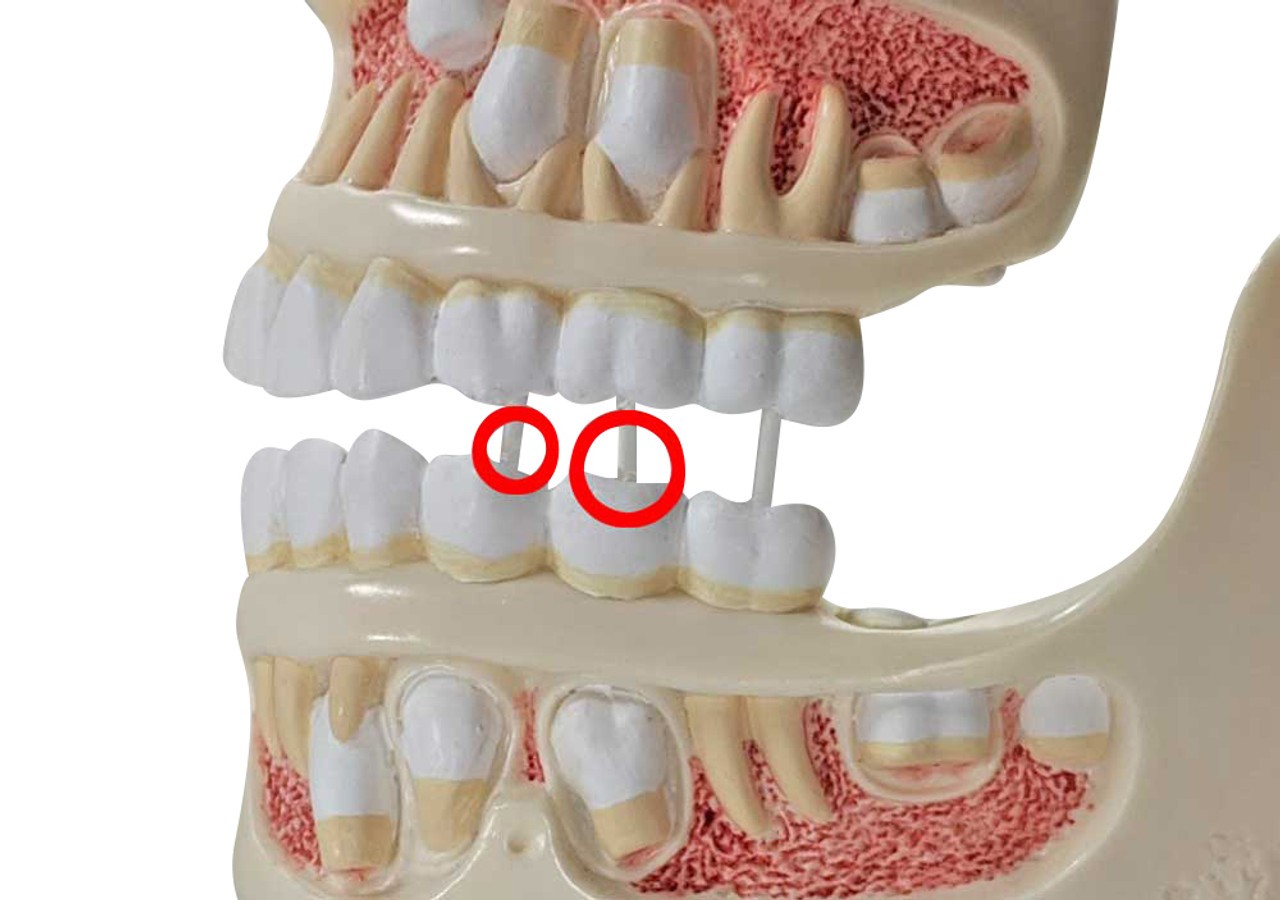 Close up of detachment, Axis Scientific 4-Stage Development of the Human Teeth - Used, Sold As-Is