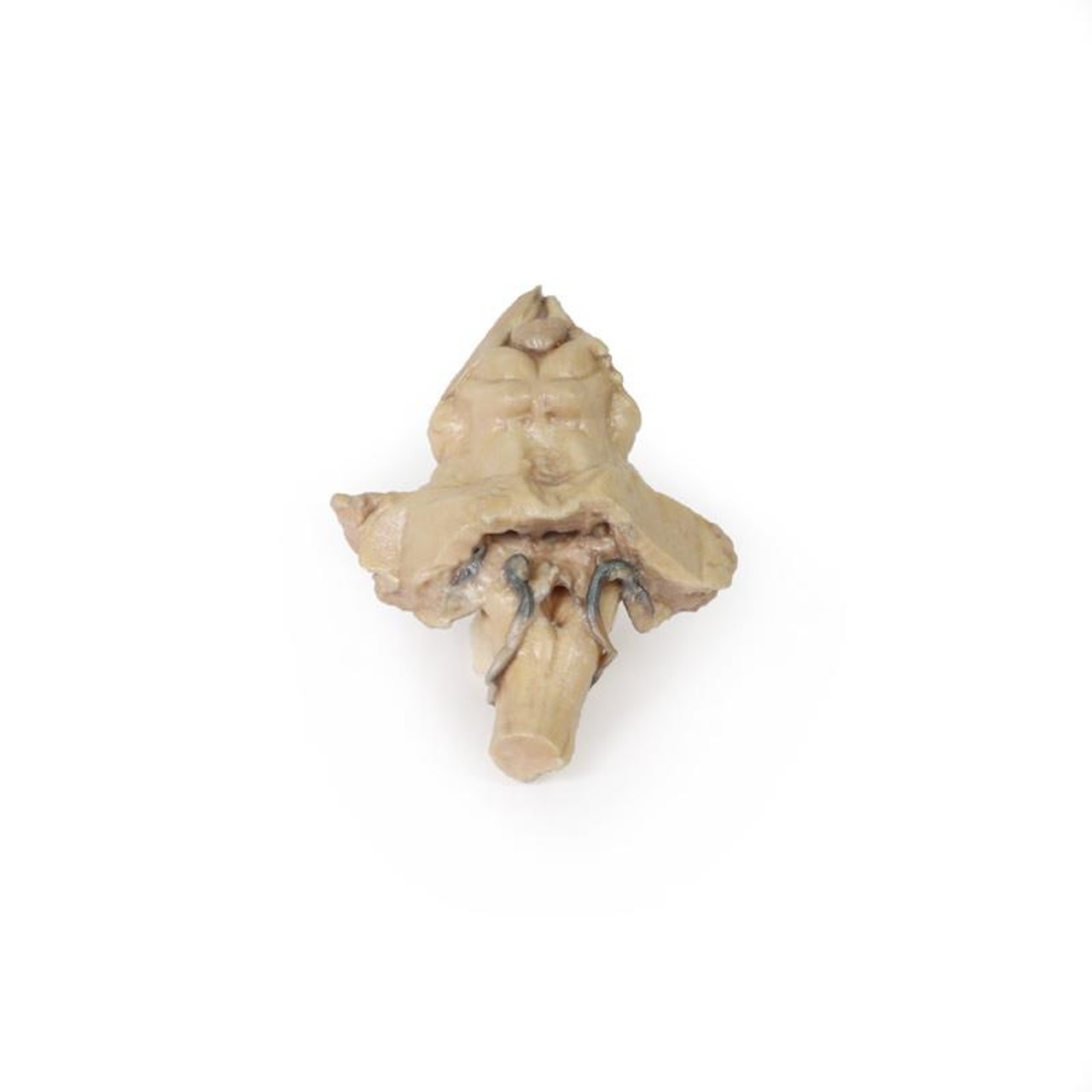 3D Printed Isolated Brain Stem from Midbrain to Medulla Oblongata