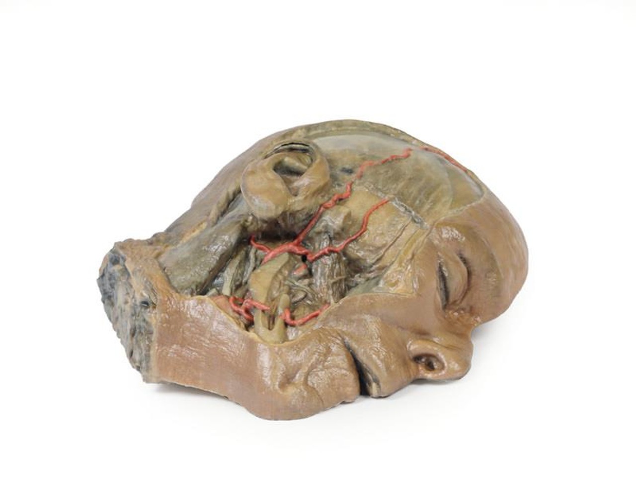 3D Printed Sagittal Section of Head with Infratemporal Fossa Dissection