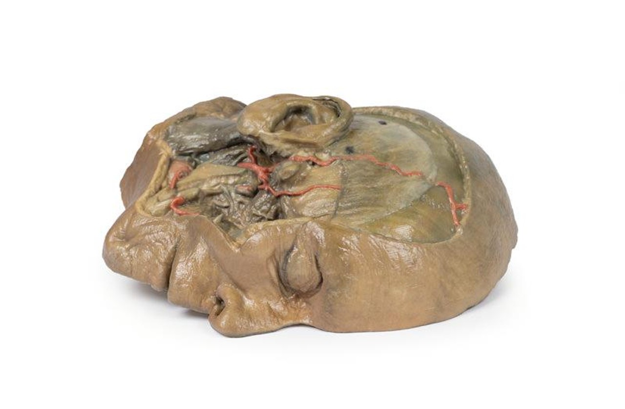 3D Printed Sagittal Section of Head with Infratemporal Fossa Dissection