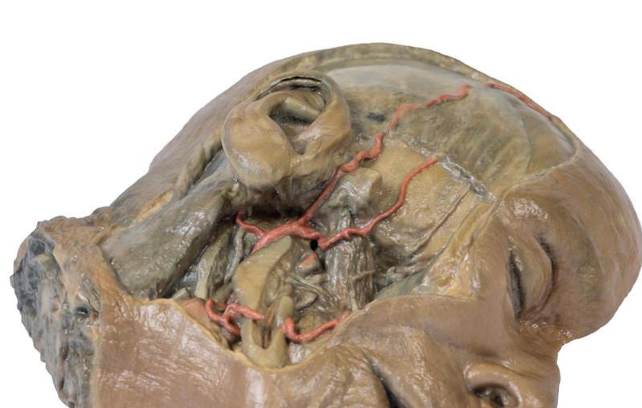 3D Printed Sagittal Section of Head with Infratemporal Fossa Dissection