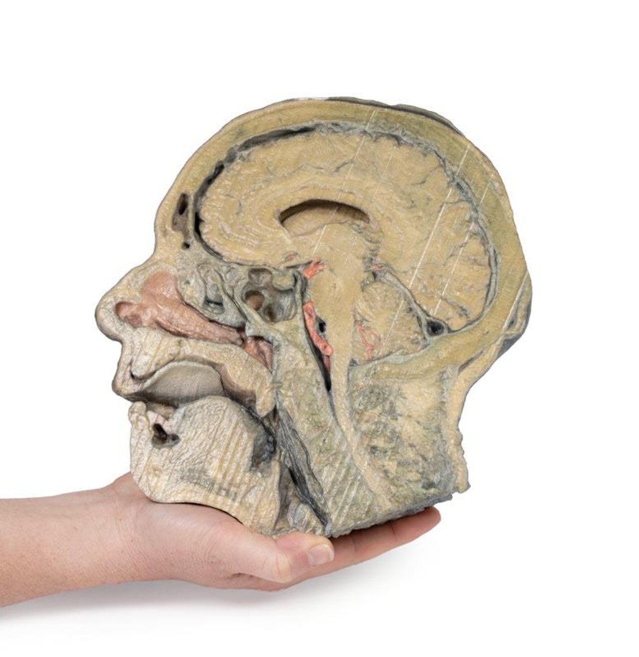 3D Printed Sagittal Section of Head with Infratemporal Fossa Dissection