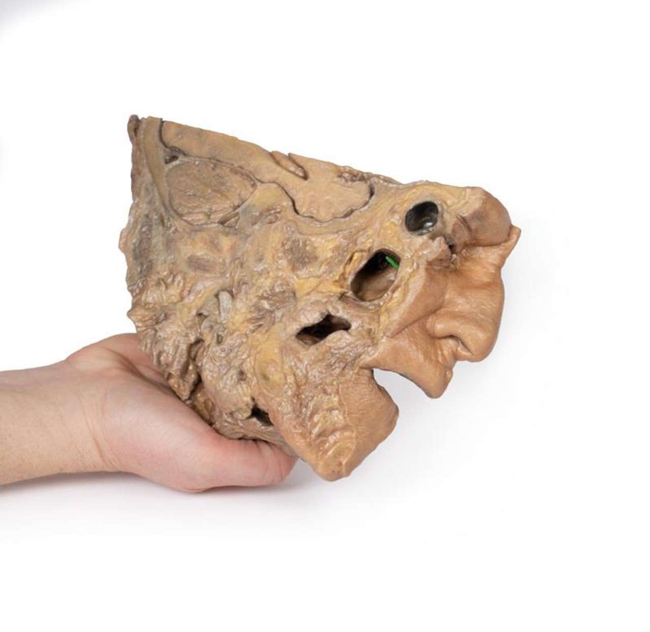 3D Printed Sinus Pathways