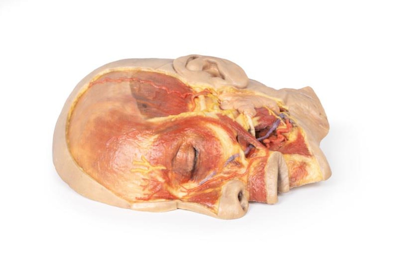3D Printed Superficial Dissection of the Face