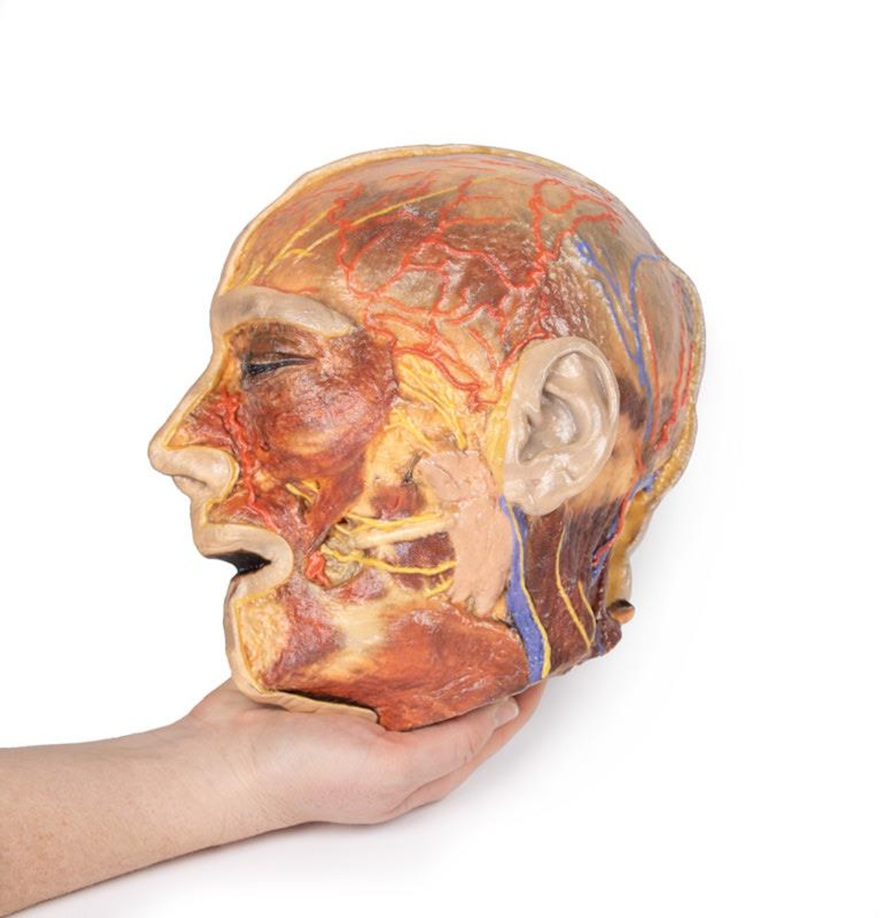 3D Printed Superficial Dissection of Facial Nerves and Parotid Gland