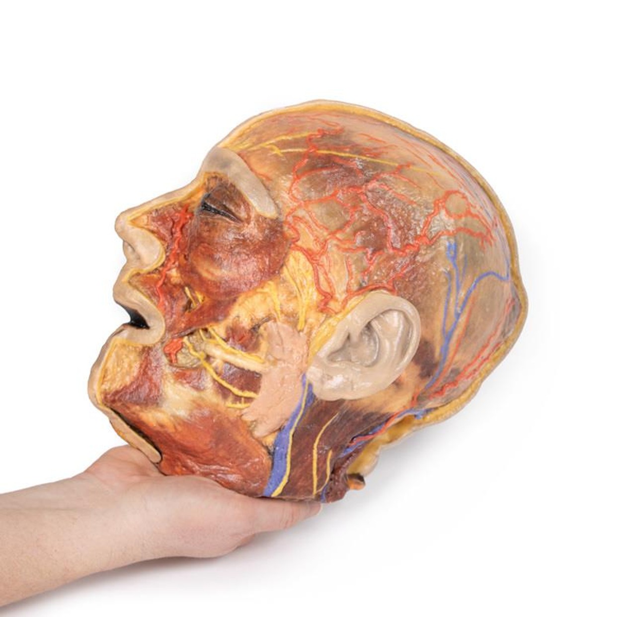 3D Printed Superficial Dissection of Facial Nerves and Parotid Gland