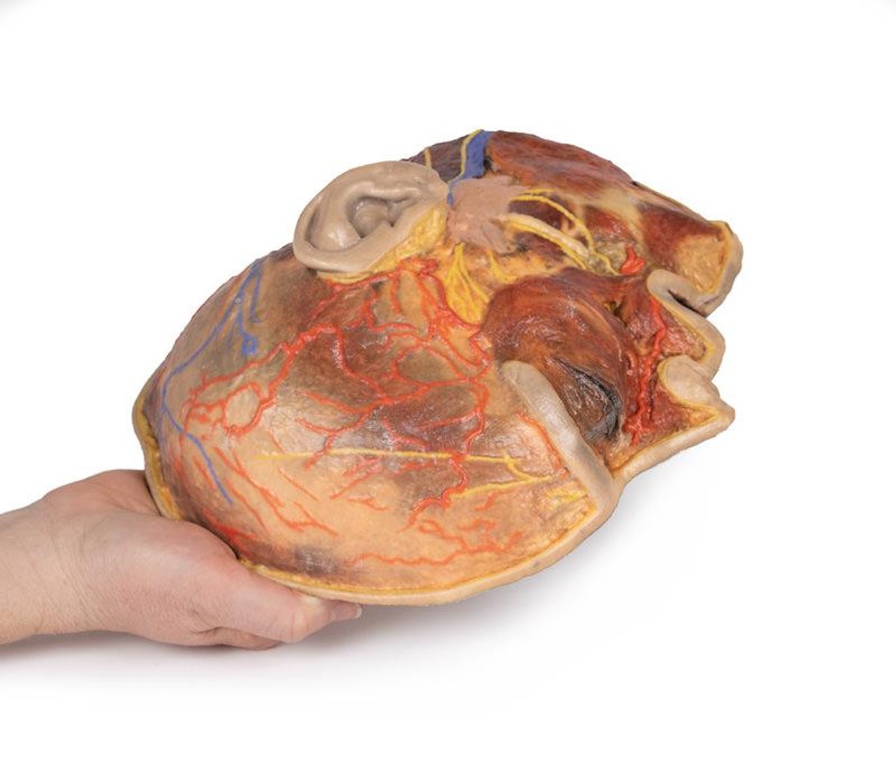 3D Printed Superficial Dissection of Facial Nerves and Parotid Gland