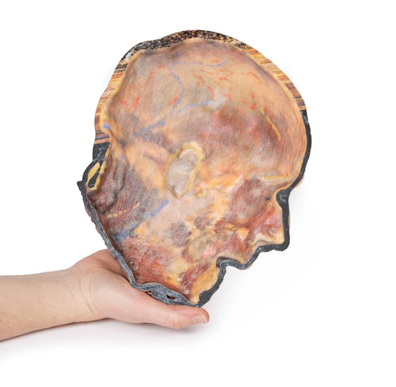 3D Printed Superficial Dissection of Facial Nerves and Parotid Gland