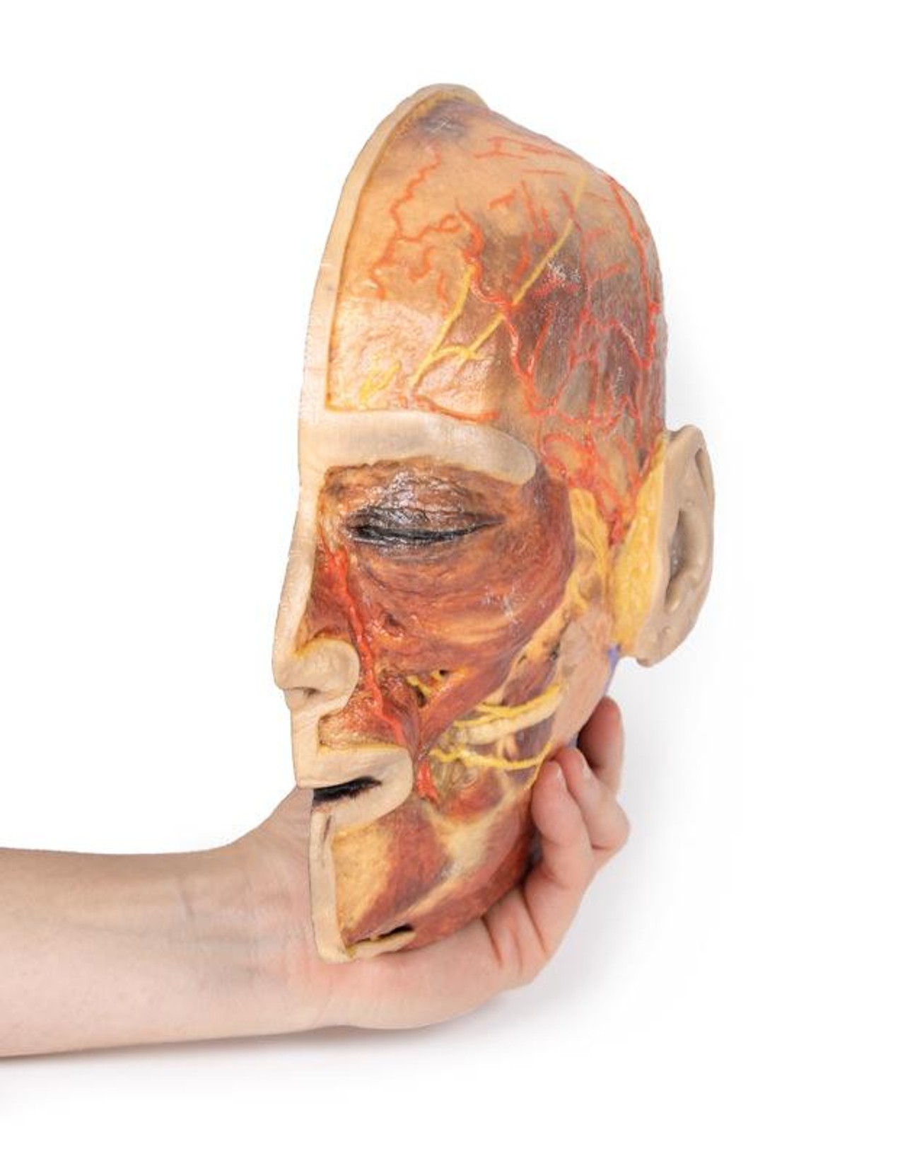 3D Printed Superficial Dissection of Facial Nerves and Parotid Gland