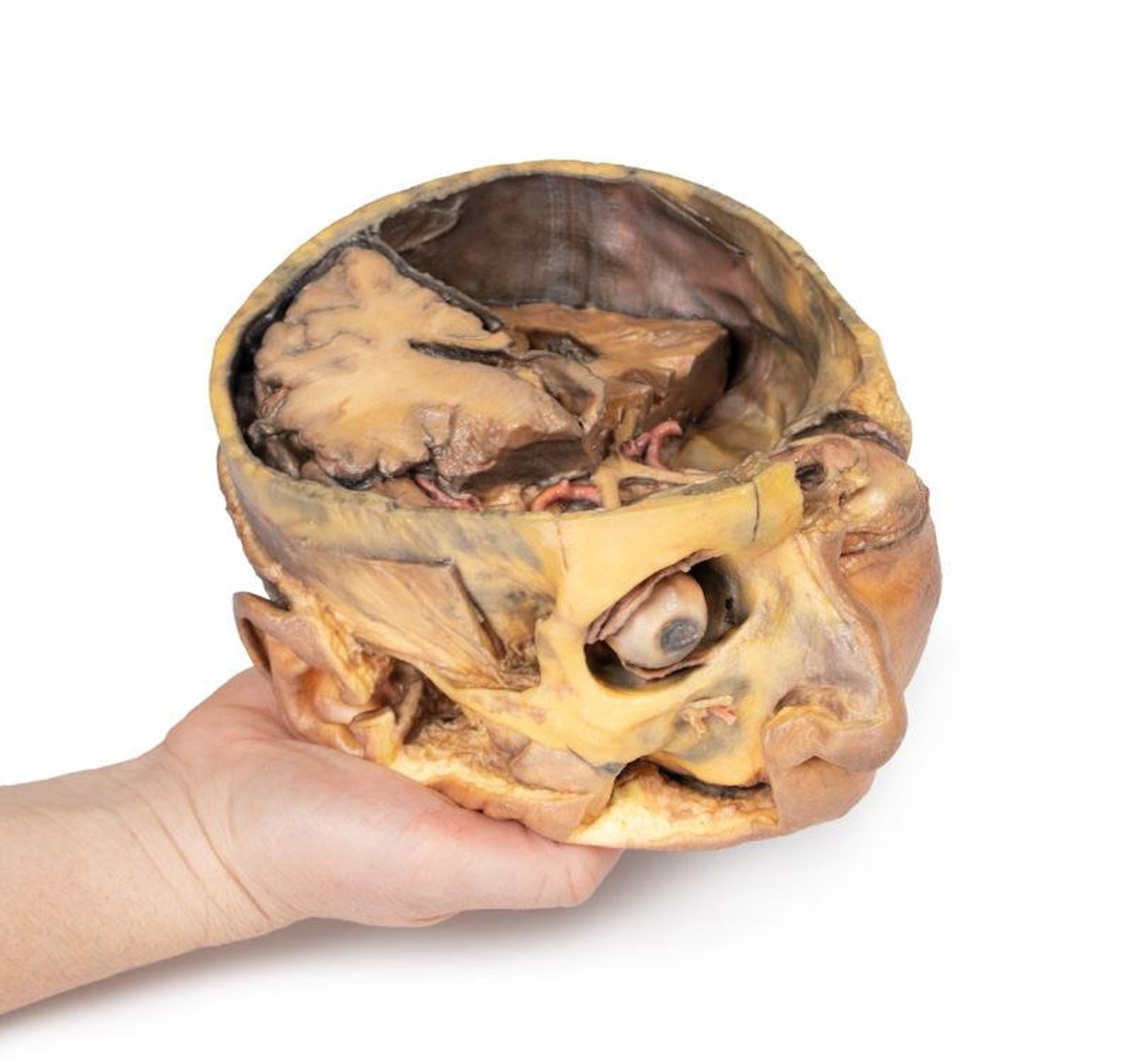 3D Printed Transverse Section of the Head